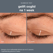 Dermalogica Phyto Nature Lifting Eye Cream