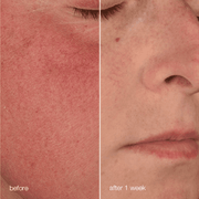 Dermalogica Stabilizing Repair Cream