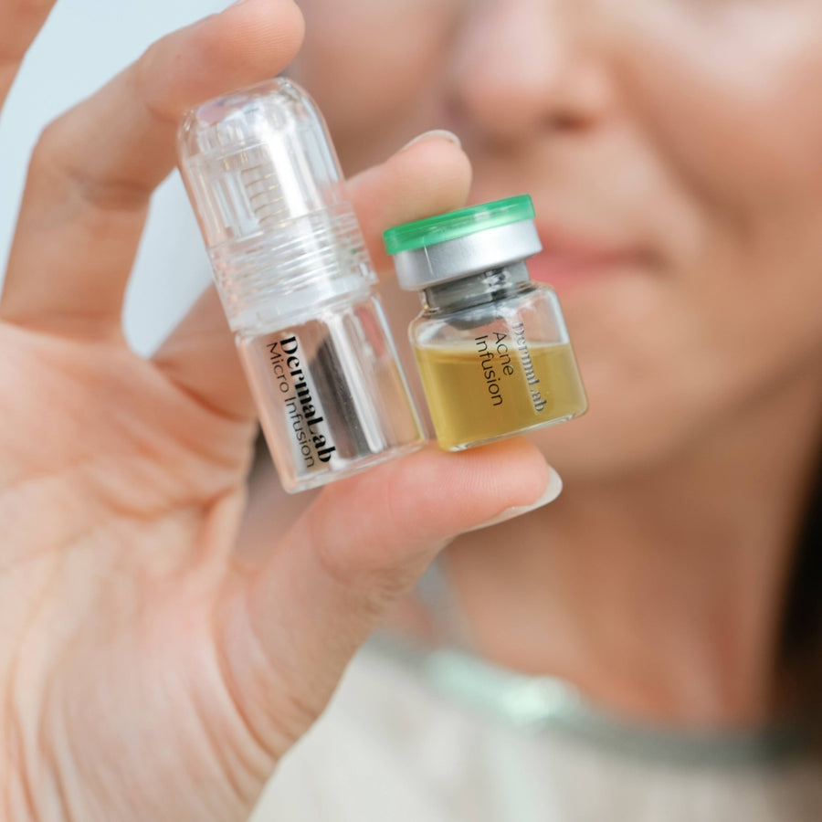 Acne Infusion 8 weken plan