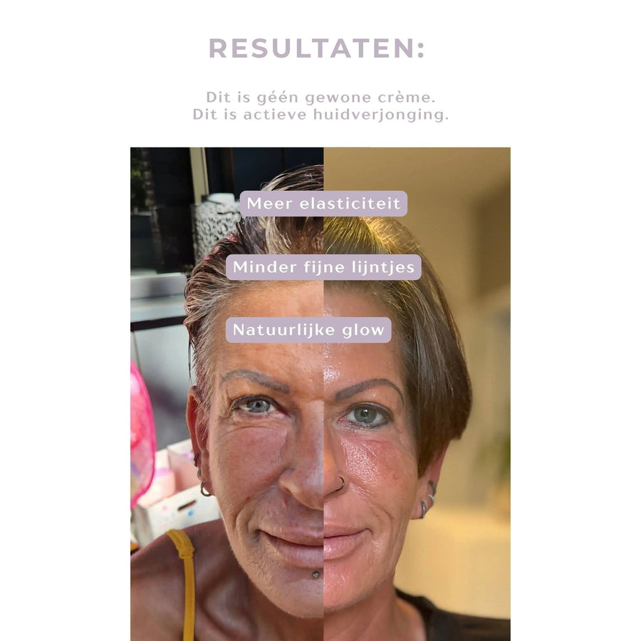 Renewal Infusion 1 maand plan