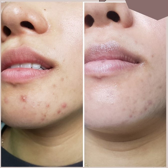 Cell Core Pro LED Mask - PRE ORDER