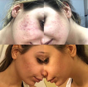 Cell Core Pro LED Mask - PRE ORDER