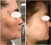 Cell Core Pro LED Mask - PRE ORDER